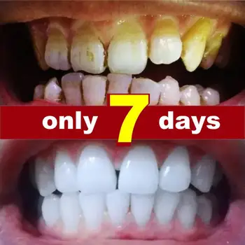 Восстановление кариеса, защита полостей зубов